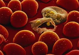 The Malaria Parasite at Work Within the Body - the MMS Solution may be the Answer...